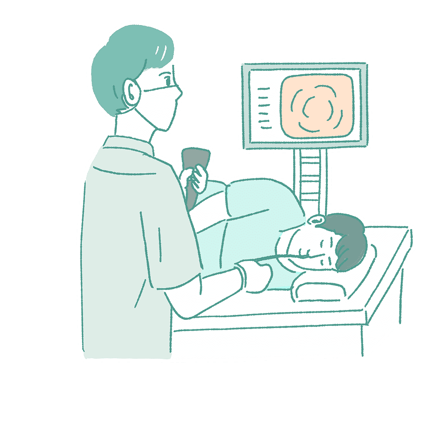 内視鏡検査のイラスト